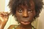 Alyssa McDonald proudly wears her scarred face